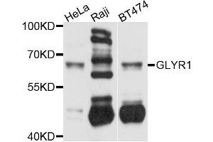 Western blot analysis of extracts of various cell lines, using GLYR1 antibody (ABIN5996127) at 1/1000 dilution. (GLYR1 Antikörper)