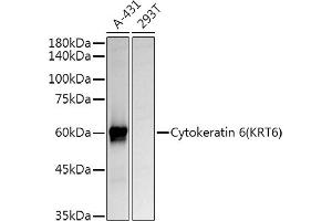 Western blot analysis of extracts of various cell lines, using Cytokeratin 6 (KRT6) Rabbit pAb antibody (ABIN6129605, ABIN6143033, ABIN6143034 and ABIN6223467) at 1:1000 dilution. (KRT6A Antikörper  (AA 305-564))