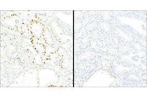 Immunohistochemistry (IHC) image for anti-Tripartite Motif Containing 28 (TRIM28) (pSer824) antibody (ABIN7454038)