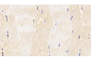Immunohistochemistry (IHC) image for anti-Caspase 6, Apoptosis-Related Cysteine Peptidase (CASP6) (AA 81-179) antibody (ABIN7426640)