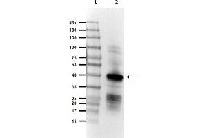 SARS-Coronavirus Nucleocapsid Protein (SARS-CoV N) Antikörper