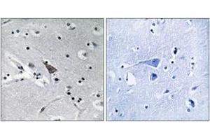 Immunohistochemistry (IHC) image for anti-Solute Carrier Family 6, Member 16 (SLC6A16) (AA 233-282) antibody (ABIN2890481) (SLC6A16 Antikörper  (AA 233-282))