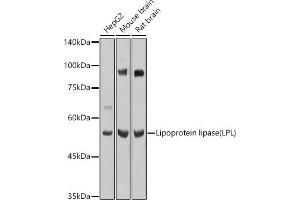 Western blot analysis of extracts of various cell lines, using Lipoprotein lipase (LPL) antibody (ABIN7268286) at 1:1000 dilution. (Lipoprotein Lipase Antikörper  (AA 124-475))
