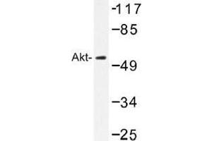Image no. 1 for anti-V-Akt Murine Thymoma Viral Oncogene Homolog 1 (AKT1) antibody (ABIN317784) (AKT1 Antikörper)