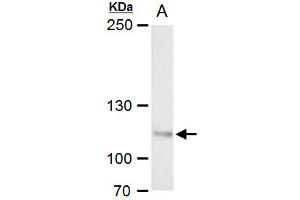 Western Blotting (WB) image for anti-O-Linked N-Acetylglucosamine (GlcNAc) Transferase (UDP-N-Acetylglucosamine:polypeptide-N-Acetylglucosaminyl Transferase) (OGT) antibody (ABIN2856718)