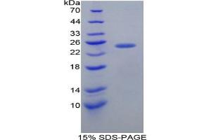 SDS-PAGE analysis of Mouse FRS2 Protein.