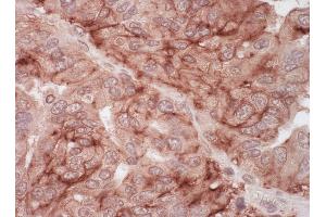 Immunohistochemistry (IHC) image for anti-Nuclear Receptor Subfamily 1, Group I, Member 3 (NR1I3) (AA 300-335) antibody (ABIN7453673)