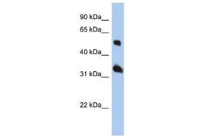 Tetraspanin 33 antibody used at 1 ug/ml to detect target protein. (TSPAN33 Antikörper  (Middle Region))