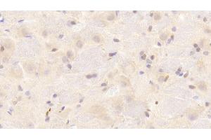 Detection of SNCa in Rat Cerebrum Tissue using Polyclonal Antibody to Synuclein Alpha (SNCa) (SNCA Antikörper  (AA 23-140))