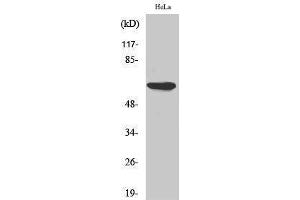 Western Blotting (WB) image for anti-Protein Kinase, AMP-Activated, alpha 1 Catalytic Subunit (PRKAA1) (Thr280) antibody (ABIN3179872) (PRKAA1 Antikörper  (Thr280))
