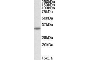 Western Blotting (WB) image for anti-Microtubule-Associated Protein, RP/EB Family, Member 3 (MAPRE3) (Internal Region) antibody (ABIN2464598) (MAPRE3 Antikörper  (Internal Region))