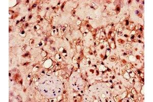 Immunohistochemistry of paraffin-embedded human placenta tissue using ABIN7155022 at dilution of 1:100 (HPSE Antikörper  (AA 263-523))