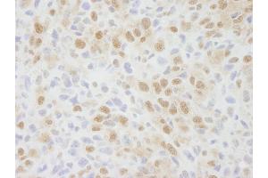Immunohistochemistry (IHC) image for anti-Zinc Finger Protein 335 (ZNF335) (C-Term) antibody (ABIN7448692) (ZNF335 Antikörper  (C-Term))