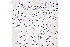 Immunohistochemistry of paraffin-embedded rat brain using SET/T Rabbit mAb (ABIN7270265) at dilution of 1:100 (40x lens).