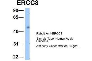 Host:  Rabbit  Target Name:  ERCC8  Sample Type:  Human Adult Placenta  Antibody Dilution:  1. (ERCC8 Antikörper  (C-Term))