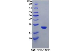 SDS-PAGE analysis of Mouse GAD1 Protein.