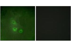 Immunofluorescence analysis of HuvEc cells, using FRK Antibody.