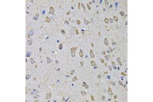 Immunohistochemistry of paraffin-embedded mouse brain using PTCD3 antibody. (PTCD3 Antikörper  (AA 450-689))