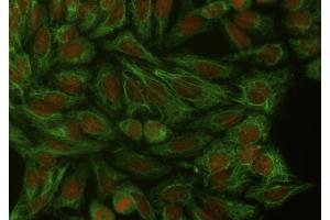 Immunocytochemistry staining of cytokeratin 18 in Hep-2 cells using mouse monoclonal antibody DA-7 ((ABIN94285), diluted 1:400), detected with GAM IgG-Alexa Fluor488 (diluted 1:200, green), cell nuclei stained with PI (1 μg/mL, orange). (Cytokeratin 18 Antikörper)