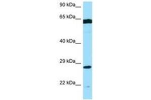 Image no. 1 for anti-Phosphomannomutase 2 (PMM2) (AA 120-169) antibody (ABIN6748475) (PMM2 Antikörper  (AA 120-169))