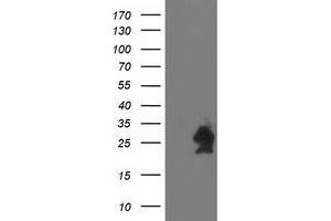 HEK293T cells were transfected with the pCMV6-ENTRY control (Left lane) or pCMV6-ENTRY HSPB7 (Right lane) cDNA for 48 hrs and lysed. (HSPB7 Antikörper)