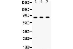 Western Blotting (WB) image for anti-Checkpoint Kinase 2 (CHEK2) (AA 465-498), (C-Term) antibody (ABIN3043811) (CHEK2 Antikörper  (C-Term))