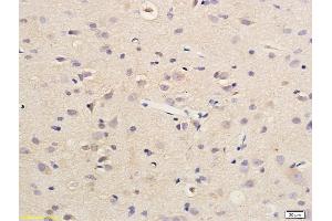 Formalin-fixed and paraffin embedded rat brain labeled with Anti SDHD Polyclonal Antibody, Unconjugated (ABIN751918) followed by conjugation to the secondary antibody and DAB staining
