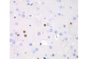 Immunohistochemistry of paraffin-embedded Rat brain using TKT Polyclonal Antibody at dilution of 1:100 (40x lens). (TKT Antikörper)