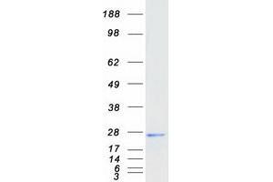 Western Blotting (WB) image for Ferritin, Mitochondrial (FTMT) protein (Myc-DYKDDDDK Tag) (ABIN2726068)