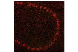 ADAM15 antibody used at a concentration of 10 ug/ml to detect cytoplasmin neurons in rodent brain (red). (ADAM15 Antikörper  (Middle Region))