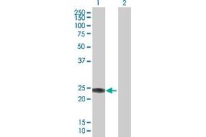 Western Blot analysis of IFNA14 expression in transfected 293T cell line by IFNA14 MaxPab polyclonal antibody. (IFNa14 Antikörper  (AA 1-189))