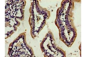 Immunohistochemistry of paraffin-embedded human small intestine tissue using ABIN7154035 at dilution of 1:100 (ENPEP Antikörper  (AA 719-949))