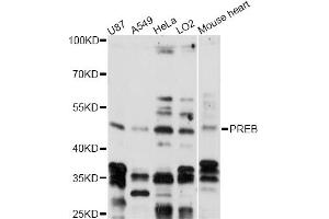Western blot analysis of extracts of various cell lines, using PREB antibody (ABIN6291189) at 1:3000 dilution. (PREB Antikörper)
