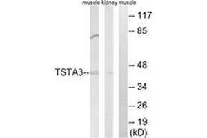 Western blot analysis of extracts from rat kidney/rat muscle cells, using TSTA3 Antibody. (TSTA3 Antikörper  (AA 221-270))