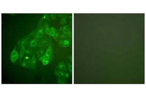 Immunofluorescence analysis of A549 cells, using Connexin 43 antibody. (Connexin 43/GJA1 Antikörper  (C-Term))