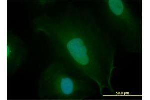 Immunofluorescence (IF) image for anti-Myc Proto-Oncogene protein (MYC) (AA 330-439) antibody (ABIN561891)