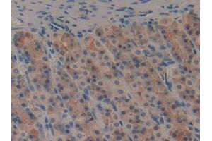 DAB staining on IHC-P; Samples: General Stomach Tissue