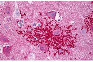 Anti-CXCR4 antibody IHC staining of human brain, astrocytes microglia. (CXCR4 Antikörper  (AA 300-349))