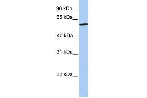 Western Blot showing ZNF284 antibody used at a concentration of 1-2 ug/ml to detect its target protein. (ZNF284 Antikörper  (Middle Region))