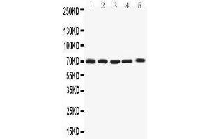 Western Blotting (WB) image for anti-Potassium Voltage-Gated Channel, Shaker-Related Subfamily, Member 4 (KCNA4) (AA 329-344), (Middle Region) antibody (ABIN3042541) (Kv1.4 Antikörper  (Middle Region))