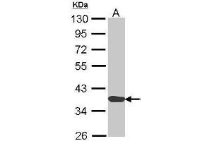 WB Image Sample (30 ug of whole cell lysate) A: H1299 10% SDS PAGE antibody diluted at 1:1000 (Annexin a1 Antikörper)