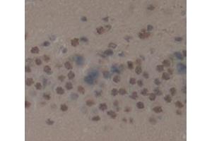 IHC-P analysis of Kidney tissue, with DAB staining. (LDOC1 Antikörper  (AA 18-147))