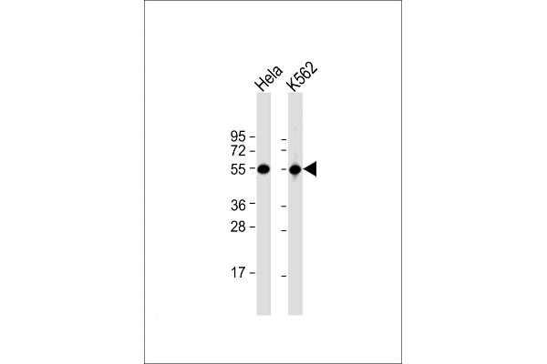 ATP6V1B1 antibody  (AA 284-310)