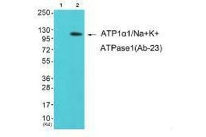 Western blot analysis of extracts from K562 cells (Lane 2), using ATP1α1/Na+K+ ATPase1 (Ab-23) antiobdy. (ATP1A1 Antikörper  (Ser23))