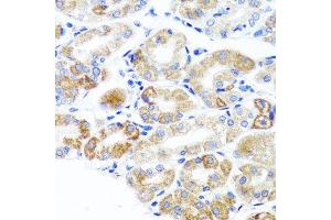 Immunohistochemistry of paraffin-embedded human stomach using DLG1 antibody at dilution of 1:100 (x40 lens).