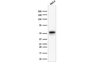 Western Blot Analysis of human HeLa cell lysate using Cytokeratin 7 Rabbit Monoclonal Antibody (KRT7/1499R).