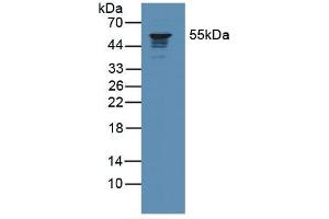Western blot analysis of Human Jurkat Cells. (Coronin 1a Antikörper  (AA 7-204))