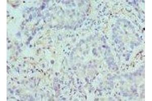 Immunohistochemistry (IHC) image for anti-Arginase, Type II (ARG2) (AA 1-354) antibody (ABIN6098038)