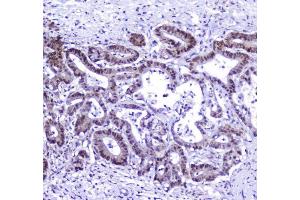 IHC analysis of AHR using anti-AHR antibody (ABIN6719265). (Aryl Hydrocarbon Receptor Antikörper)