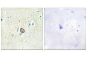 Immunohistochemistry analysis of paraffin-embedded human brain tissue using CELSR3 antibody. (CELSR3 Antikörper)